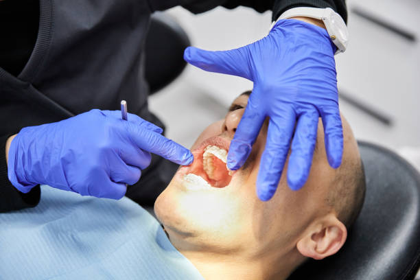 Best Emergency Dentist for Lost Fillings or Crowns in Lauderdale Lakes, FL